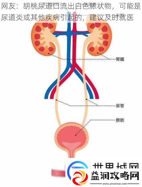 网友：胡桃尿道口流出白色脓状物-可能是尿道炎或其他疾病引起的-建议及时就医